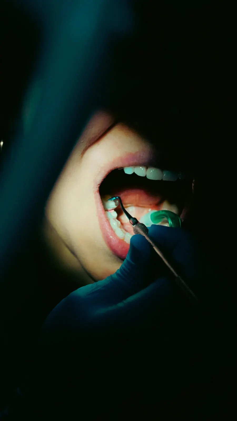 Diagnóstico y caries en Jujuy — Centro Dental Anze
