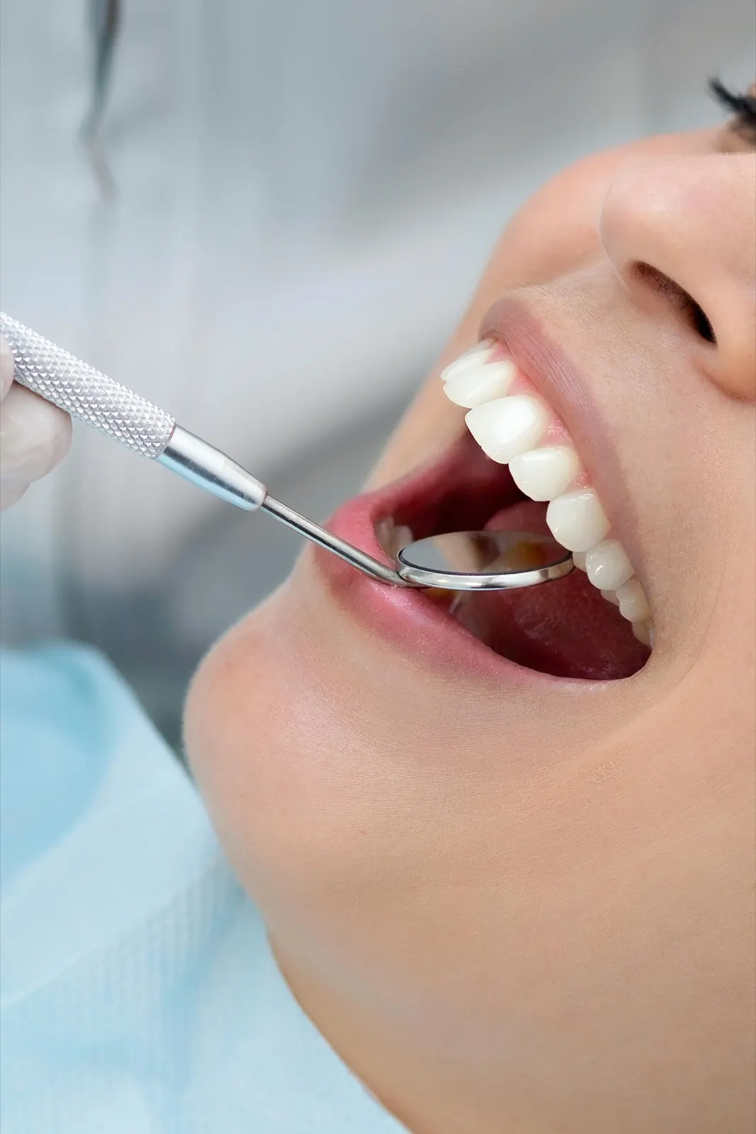 Detalle de chequeo odontológico — Centro Dental Anze, San Salvador de Jujuy